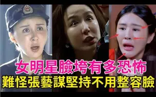 Descargar video: 女明星脸垮有多恐怖！看看毛晓彤、金晨就知道了，难怪张艺谋坚持不用整容脸