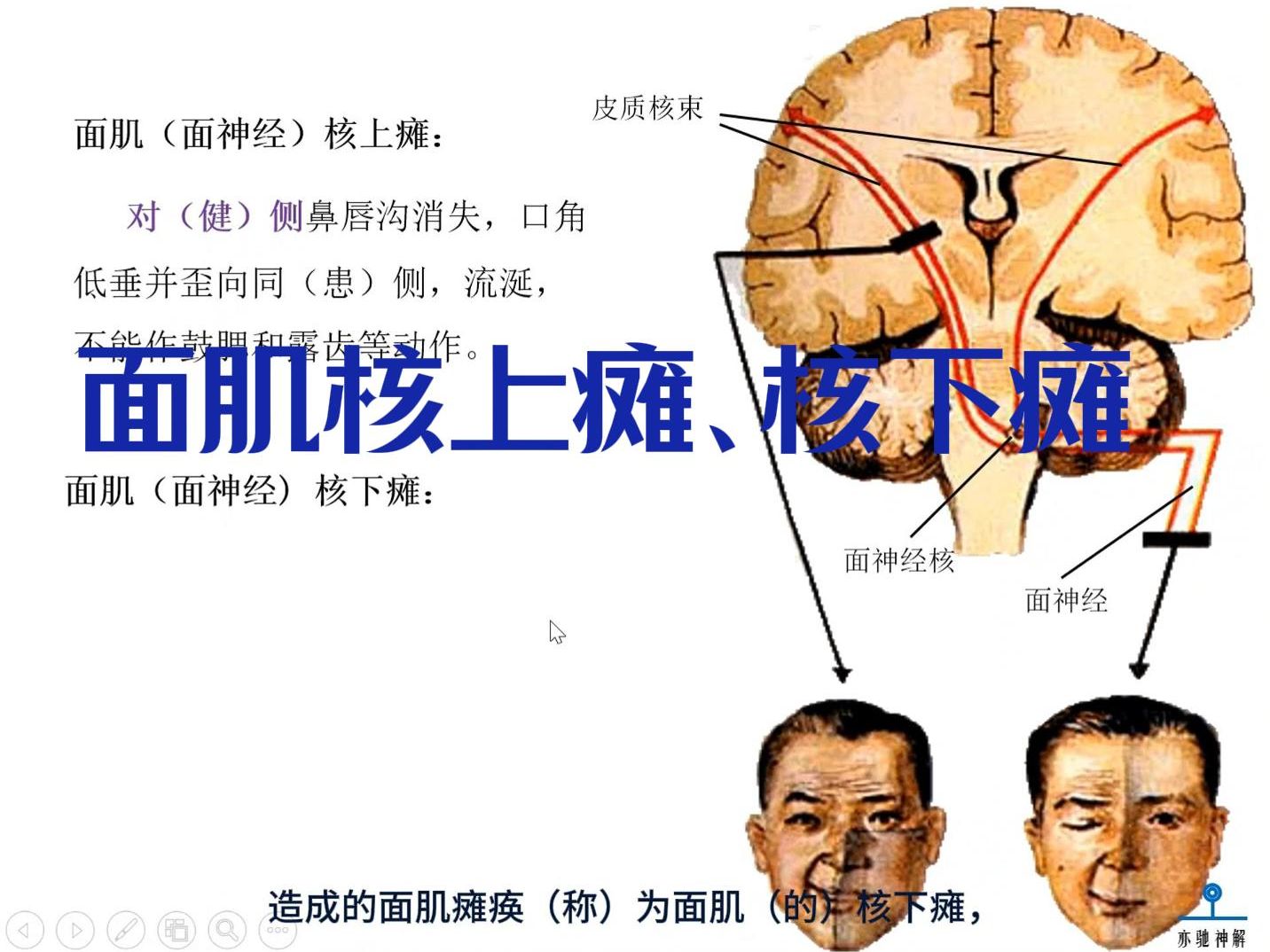 神经解剖学:面肌核上瘫、核下瘫哔哩哔哩bilibili