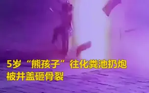 Tải video: 又一起！5岁男童往化粪池扔炮被井盖砸骨裂