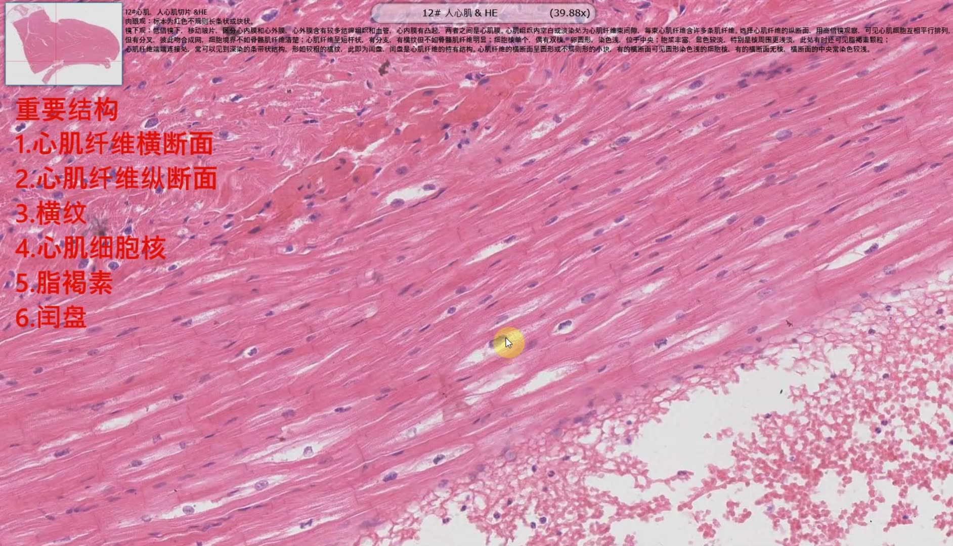 心肌组织组织切片解读哔哩哔哩bilibili