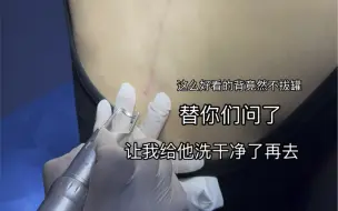 Tải video: 替你们问了 不拔罐  只是单纯洗个纹身 告别青春年少时的那场梦。