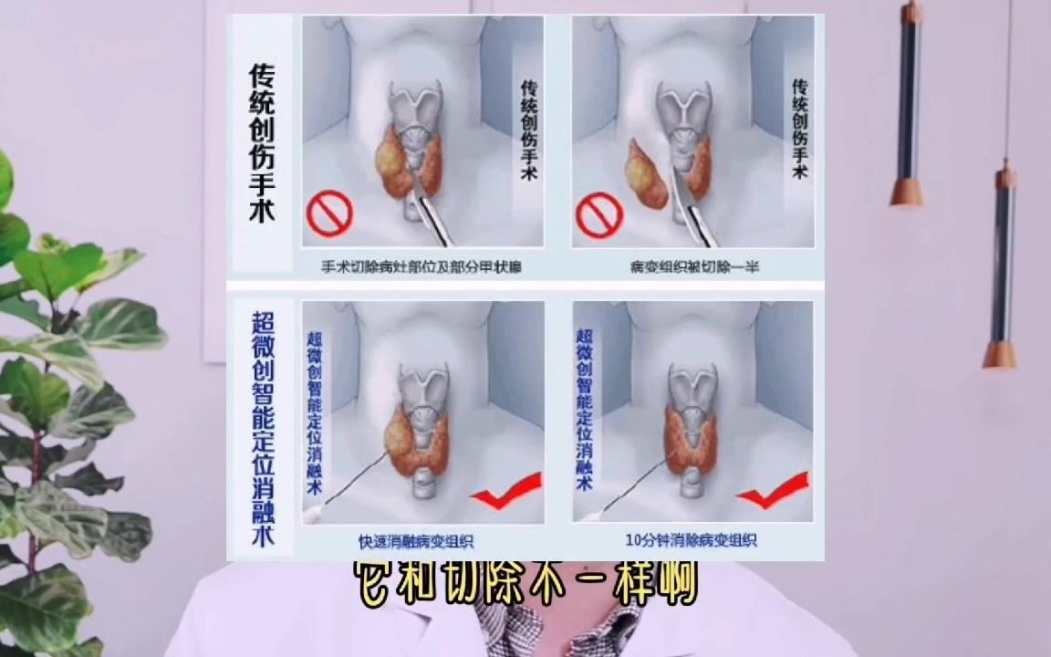 甲狀腺結節手術可以不開刀嗎?