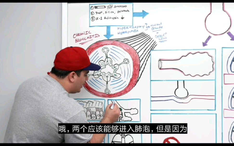 内科:1章 COPD图解(病理生理) a哔哩哔哩bilibili