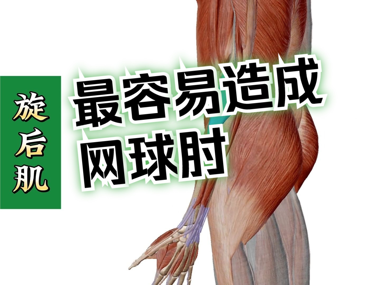 【旋后肌】3d解剖——最容易造成网球肘的肌肉!