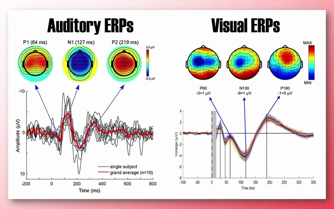 什么是erp?事件相关电位是什么(ERP) explained哔哩哔哩bilibili