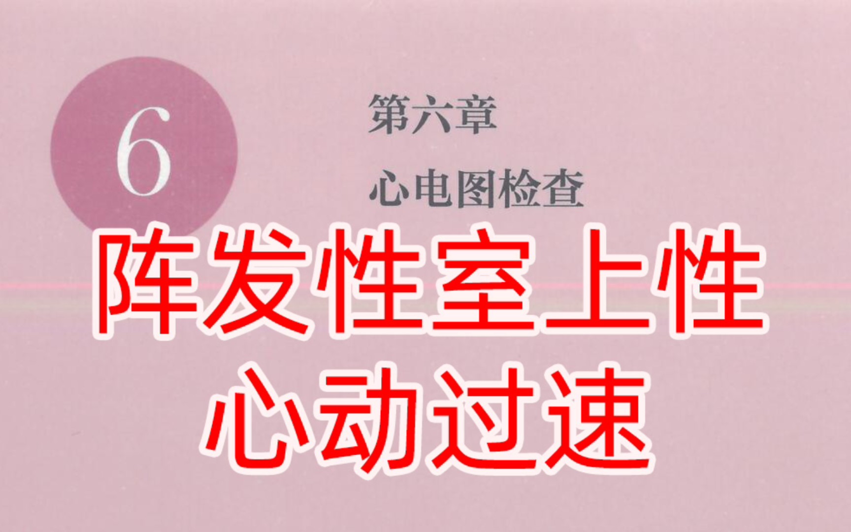 【心電圖】陣發性室上性心動過速