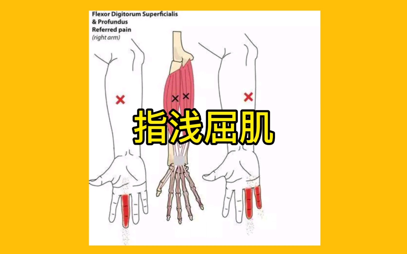 指浅屈肌的功能解剖