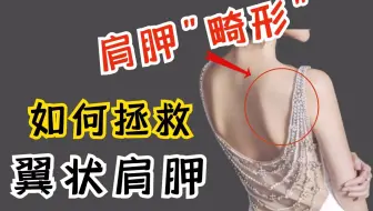 教你如何矫正翼状肩胛骨 哔哩哔哩 Bilibili