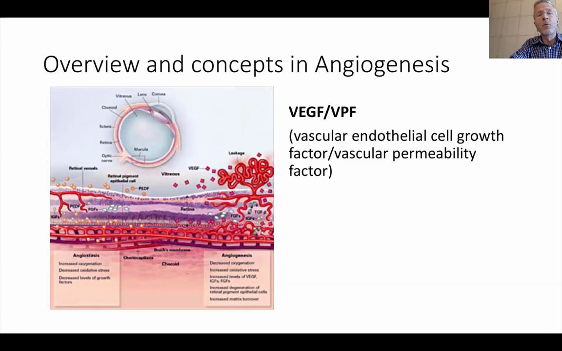 VEGF and antiVEGF in Eye Disease  血管生长因子和需抗VEGF的眼科疾病哔哩哔哩bilibili