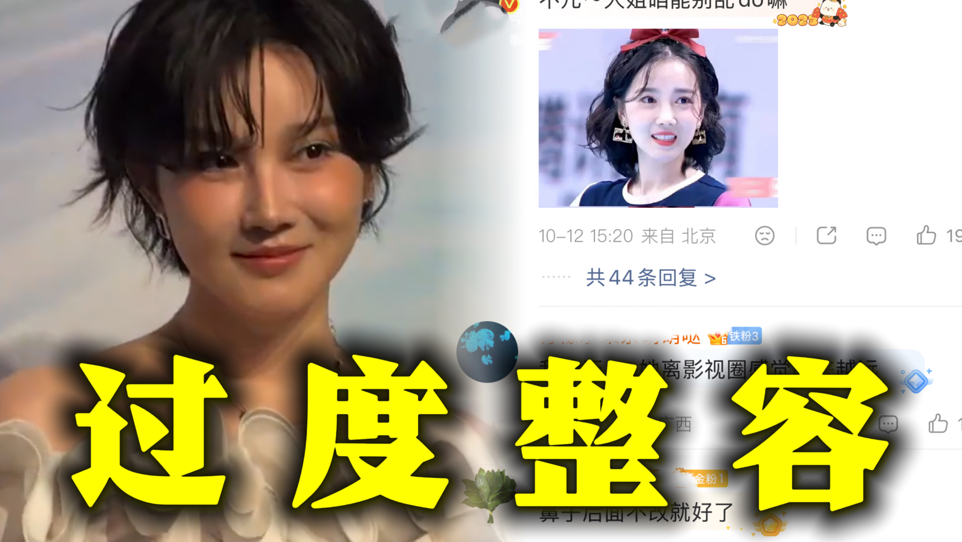 天呐! 陈小纭脸因整容馒化冲上热搜 她近期出席活动视频被曝, 脸部过于馒化僵硬被网友质疑整容后遗症, 其实她早就承认过自己整骨十次...