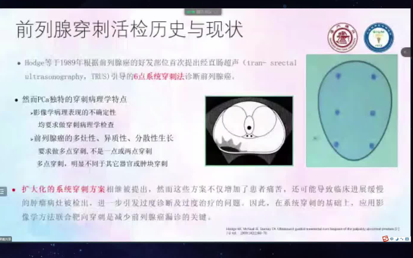 《前列腺穿刺临床经验分享》搬运自用哔哩哔哩bilibili