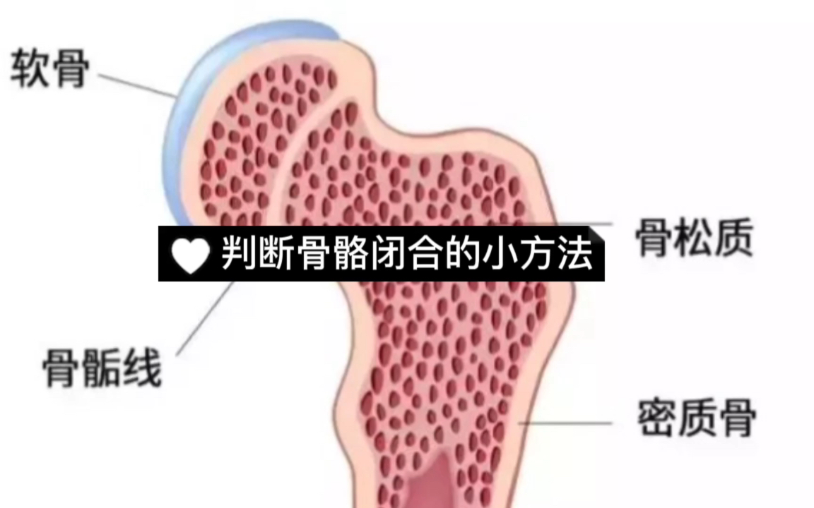 判断骨骼闭合的小方法哔哩哔哩bilibili