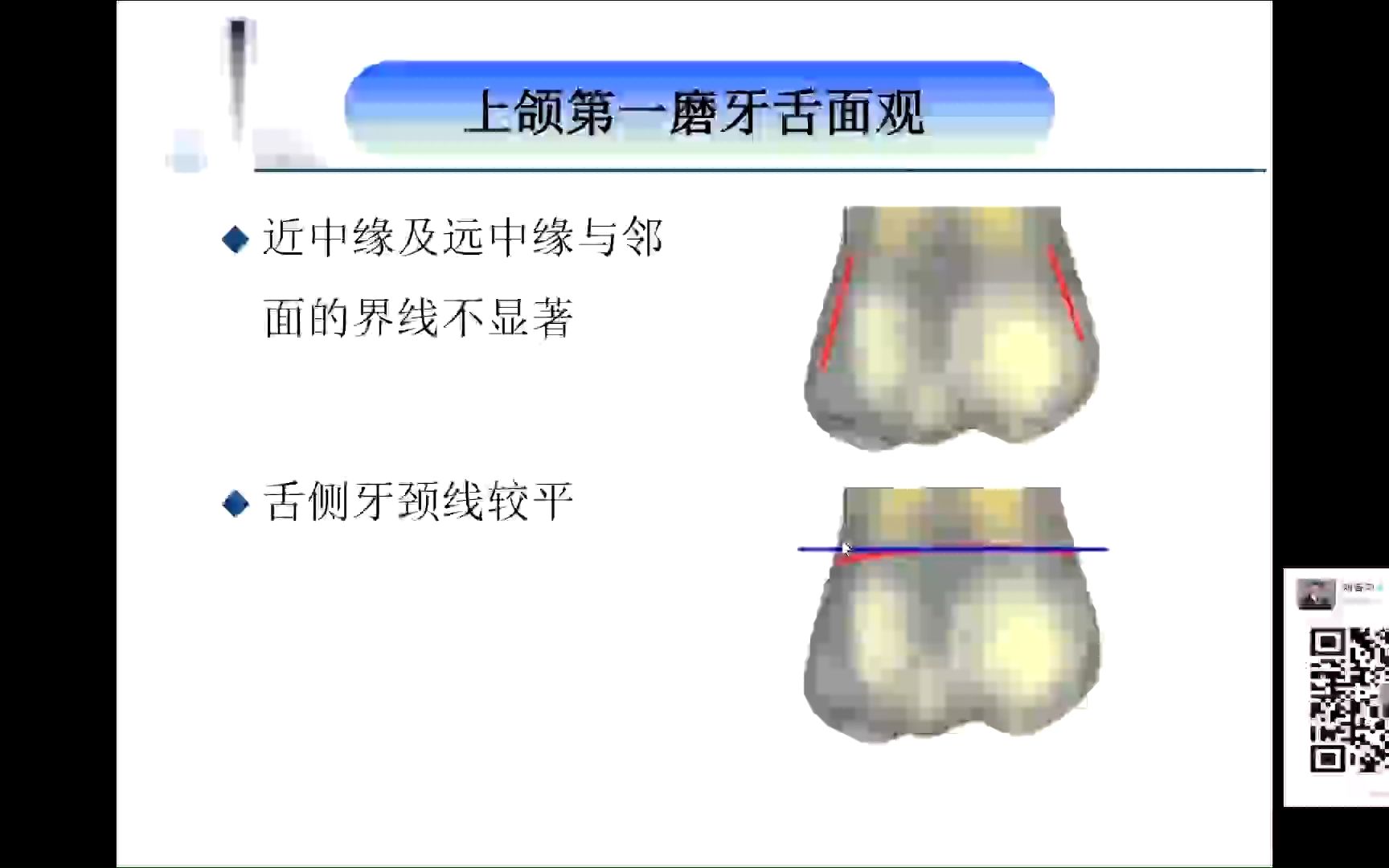 [图]第一节，上颌第一磨牙