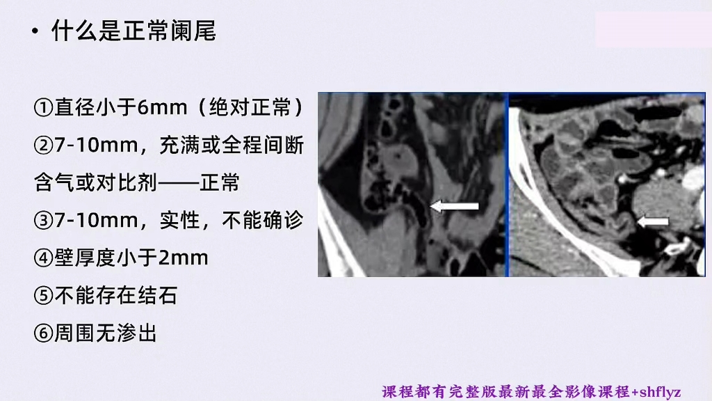 擅长：消化系统、呼吸系统疾病与软组织肿瘤病理诊断、肿瘤耐药与靶向治疗的基因检测应用、电...票贩子挂号推荐，用过的都说好的简单介绍