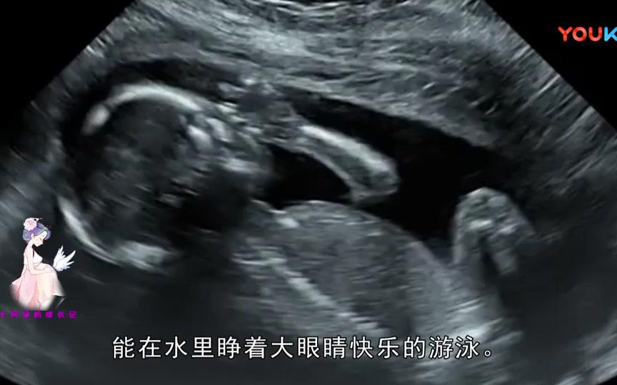 原来孕26周胎宝宝睁开眼睛后, 肚子里看过去是这样子的, 他很惊喜