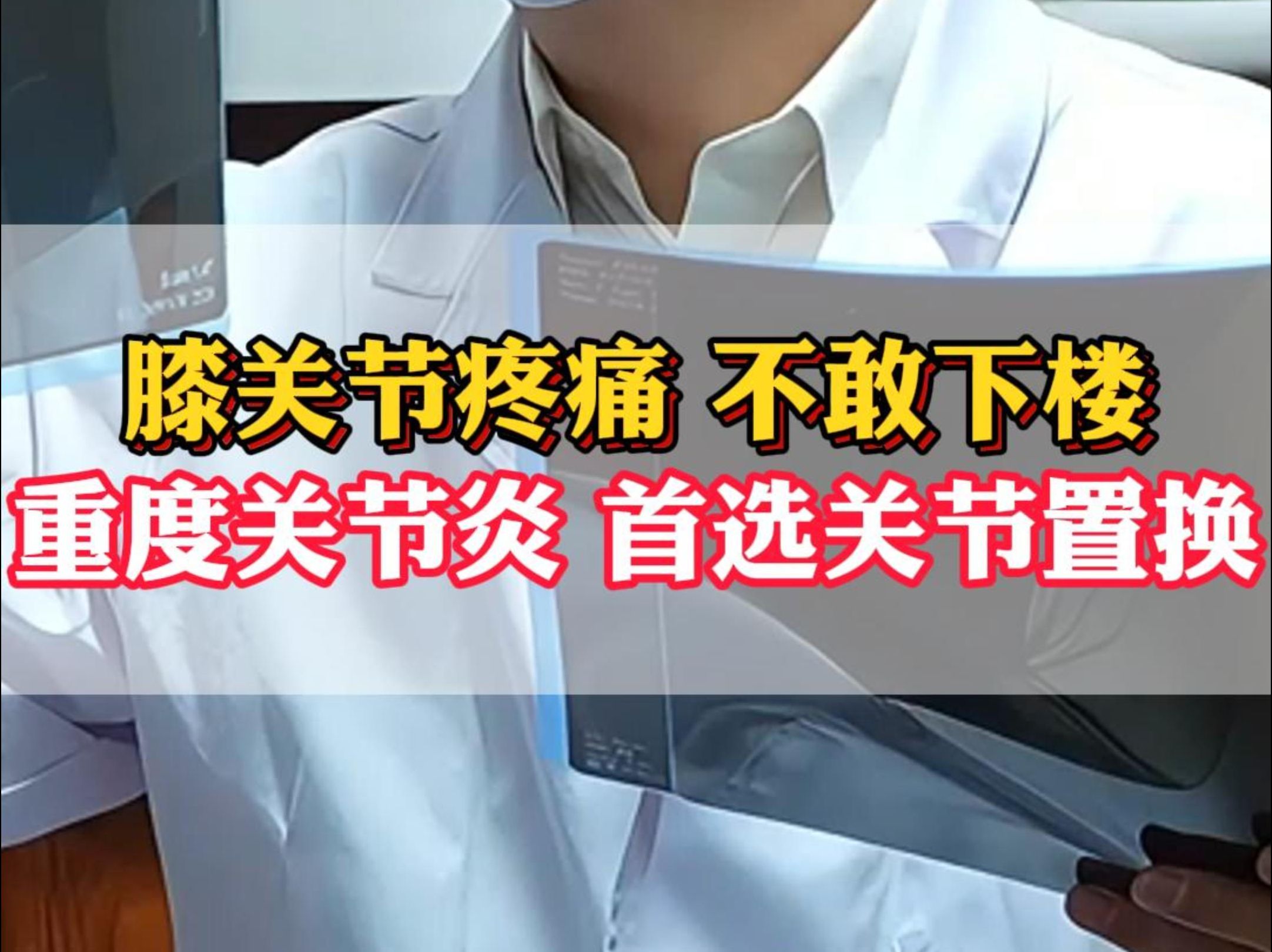 重度骨关节炎,膝盖疼痛下不了楼蹲不下,最佳方案膝关节置换