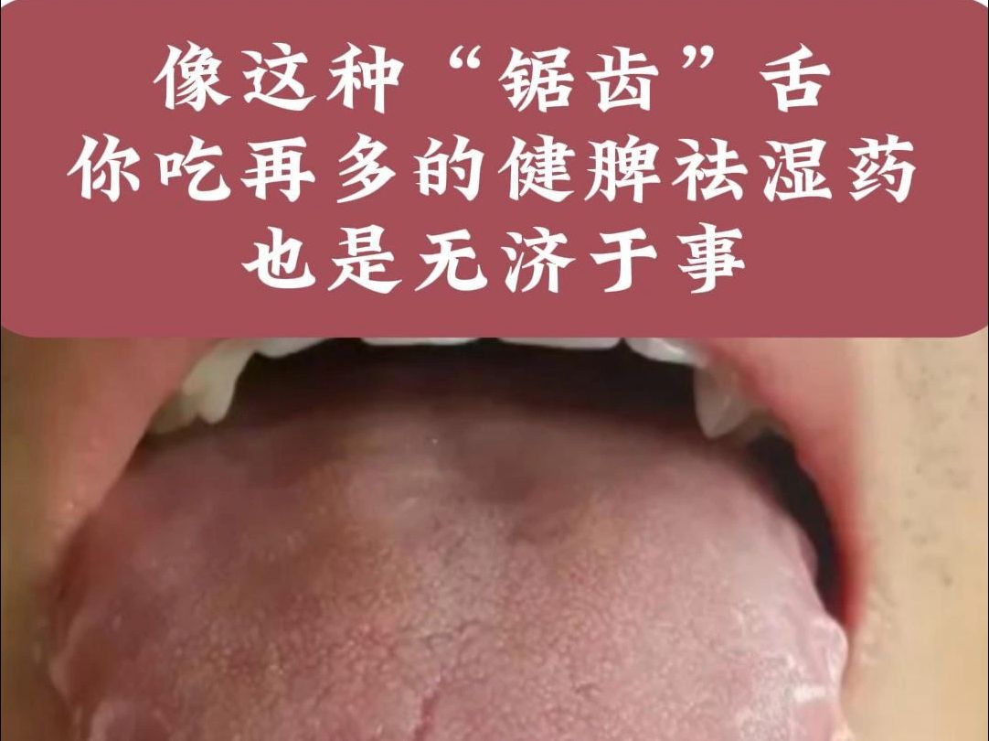 锯齿形舌头图片