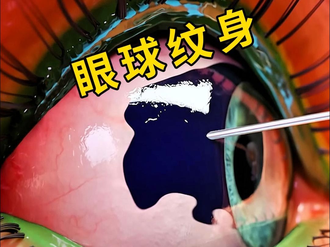 眼球纹身为什么比普通纹身更危险?哔哩哔哩bilibili