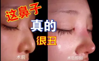 鹰钩鼻 搜索结果 哔哩哔哩 Bilibili