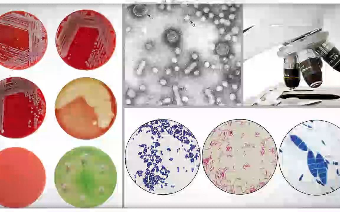 [11.1.2] 霍乱弧菌的致病性、微生物学检查和防治哔哩哔哩bilibili