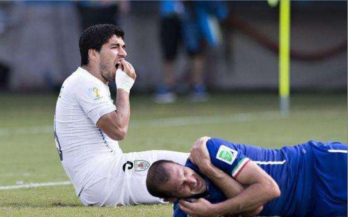 基耶利尼:裁判,我特么手臂被咬了!苏亚雷斯:裁判,我牙咬疼了