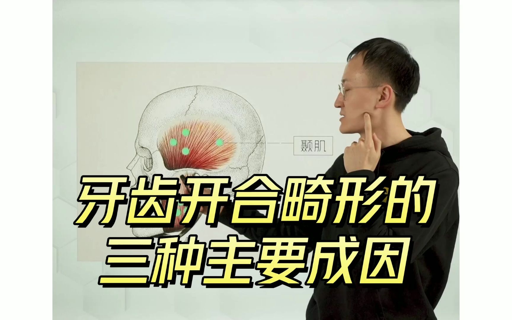 牙齿开合畸形的三种主要成因及正畸矫正方法哔哩哔哩bilibili