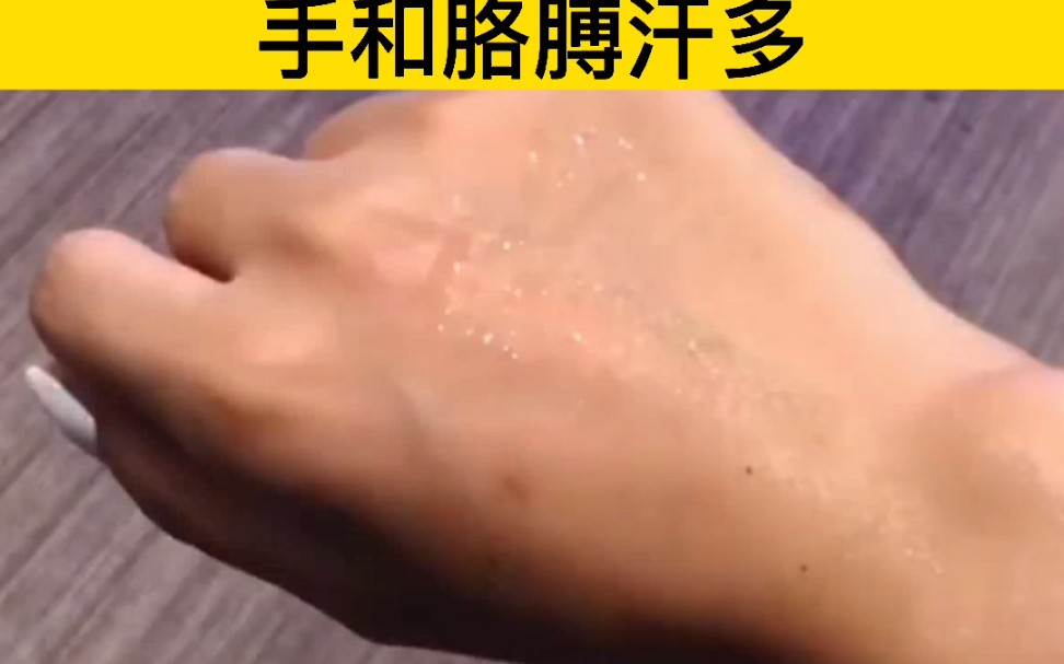 手和胳膊出汗多很严重
