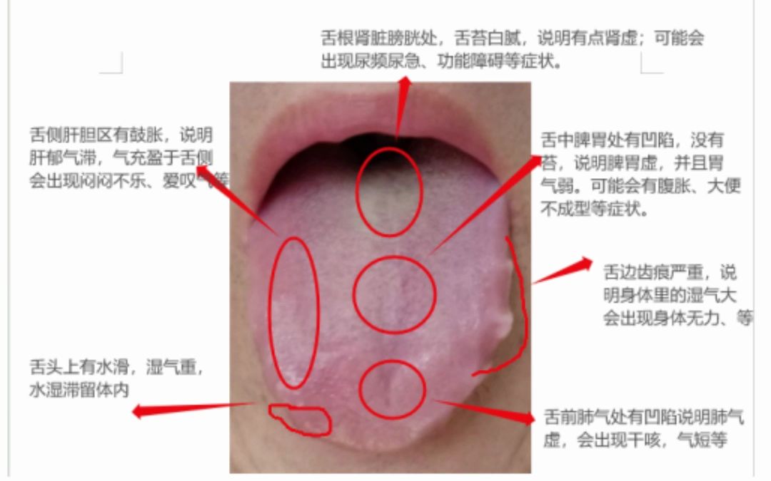 舌头有裂纹图解图片