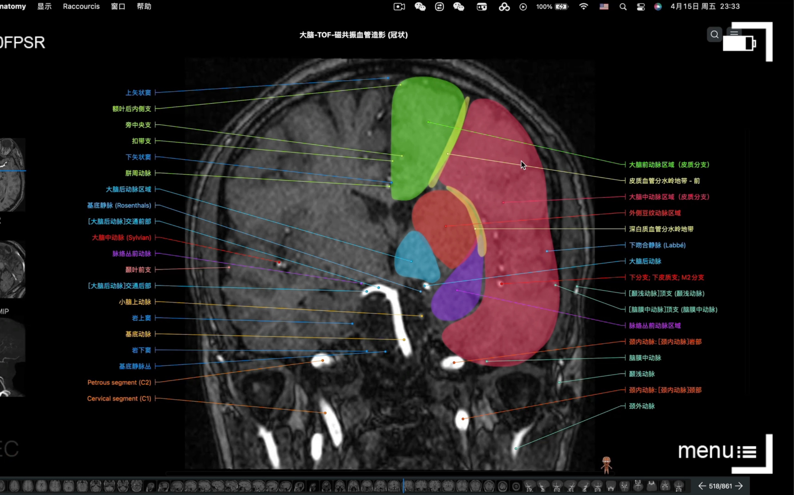 [图]推荐一个超好用的中文版断层影像解剖图谱（应用名称：e-anatomy）