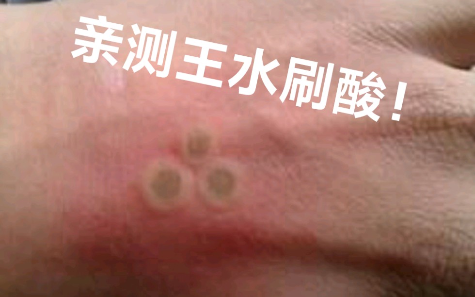 王水泼洒该怎么处理?up亲测王水刷酸?真能变白?哔哩哔哩bilibili