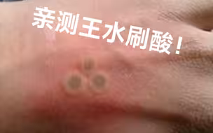 王水泼洒该怎么处理？up亲测王水刷酸？真能变白？