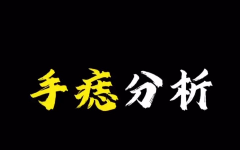 【面相解读】手痣分析哔哩哔哩bilibili