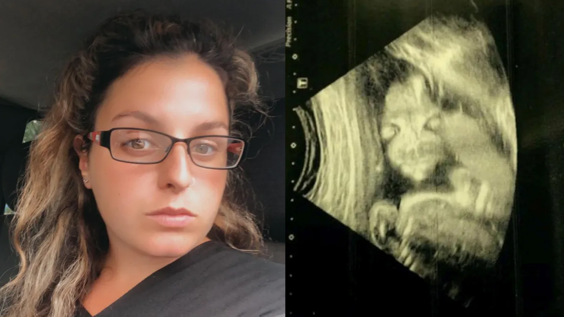 20周胎儿图图片
