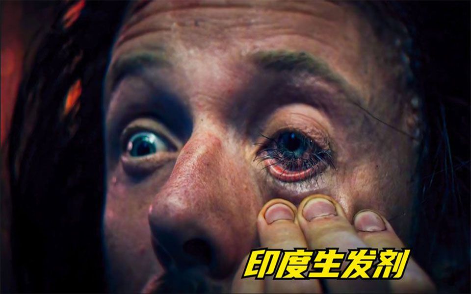 恐怖片:男人意外将印度生发剂弄到眼睛里,结果眼睛里竟长出头发.