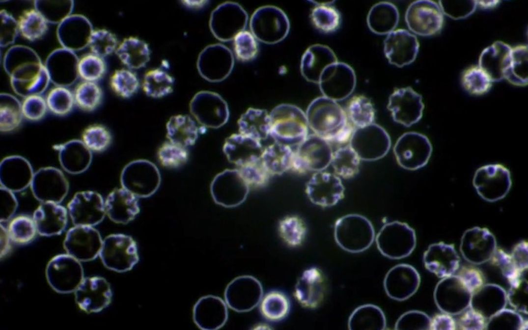 带你看工作细胞显微镜观察血细胞含暗场