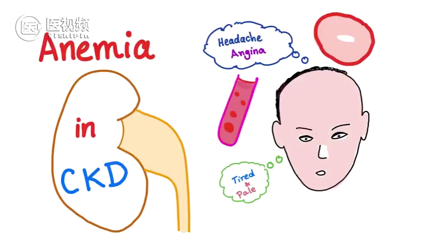 EPO:促红细胞生成素对慢性肾脏病的影响:慢性肾脏病CKD哔哩哔哩bilibili