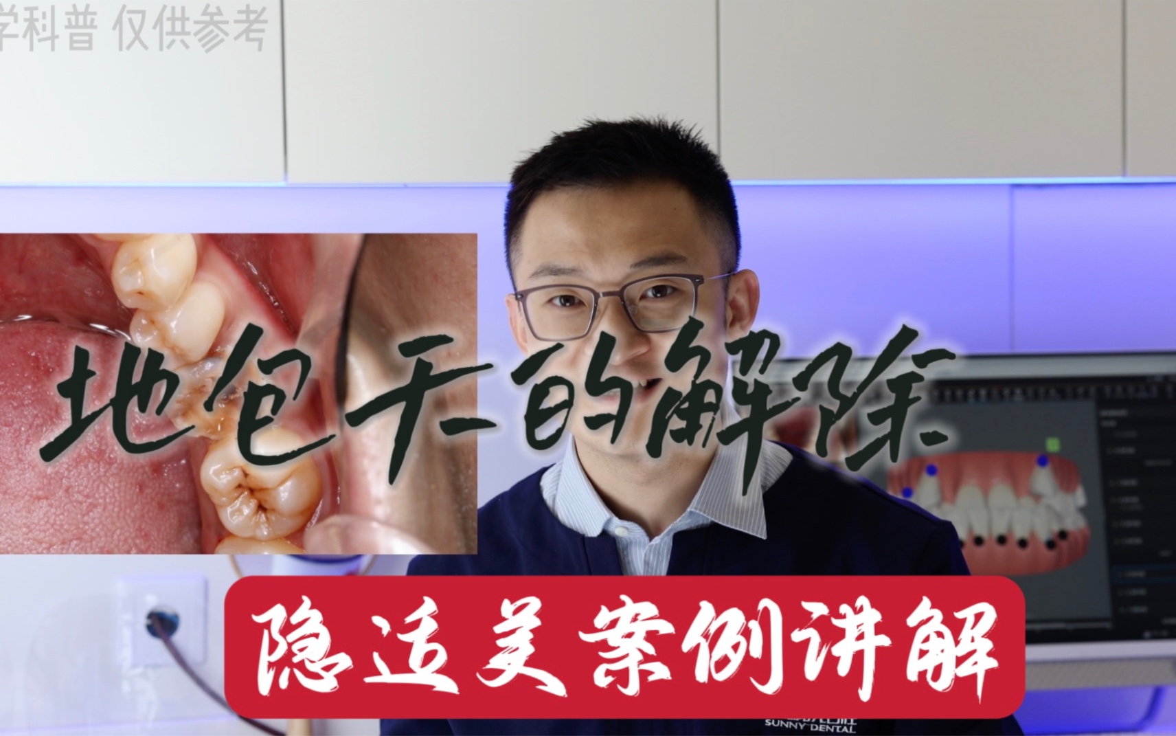 精彩案例分享,3大难点集合(隐适美)哔哩哔哩bilibili