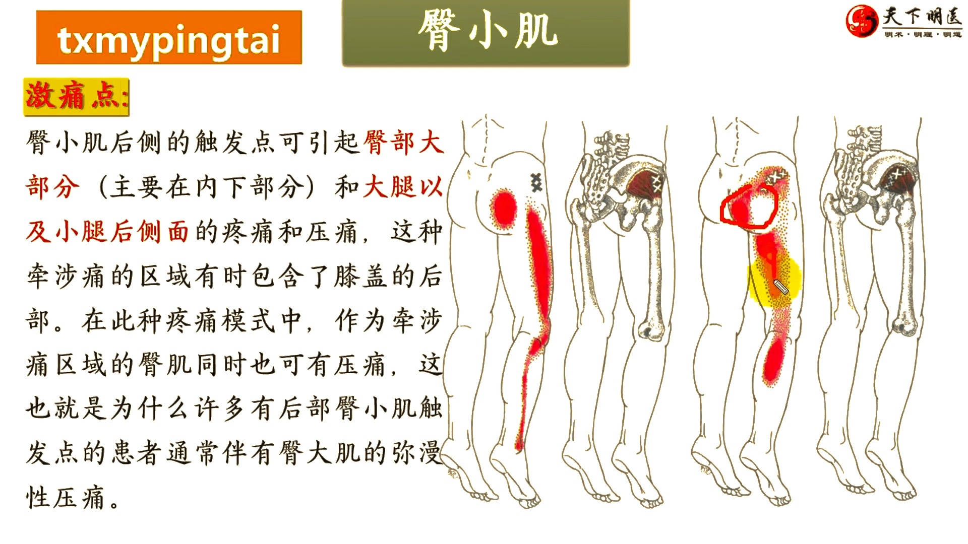 臀裂位置图片图片