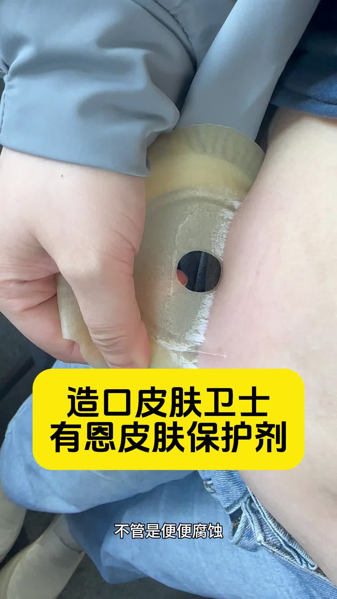 造口皮肤卫士,有恩皮肤保护剂