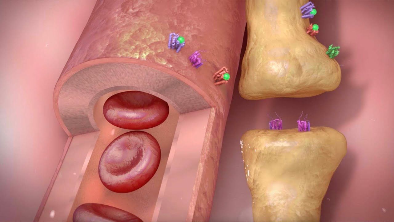 偏头痛的机制与治疗药物分类 | 医学动画 | 健康教育哔哩哔哩bilibili