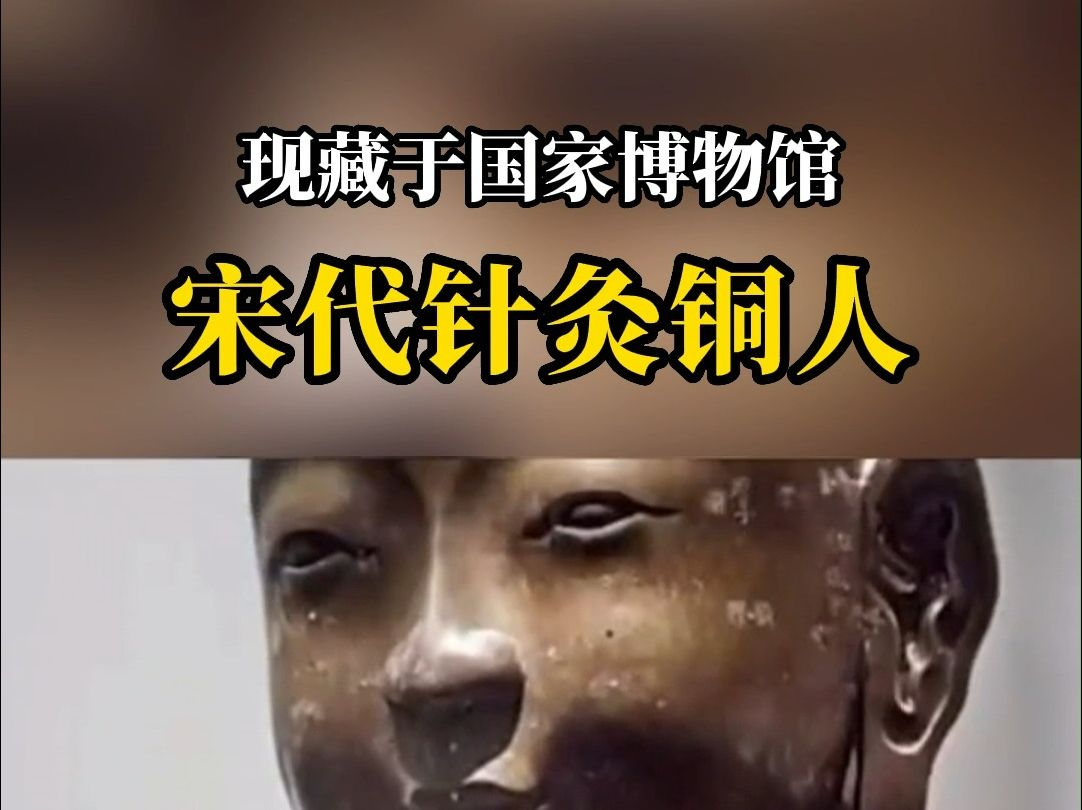 老祖宗的智慧之宋代针灸铜人,现藏于国家博物馆