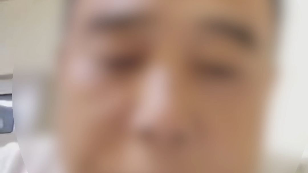 男子被狗咬伤后不幸离世，生前录视频提醒大家。