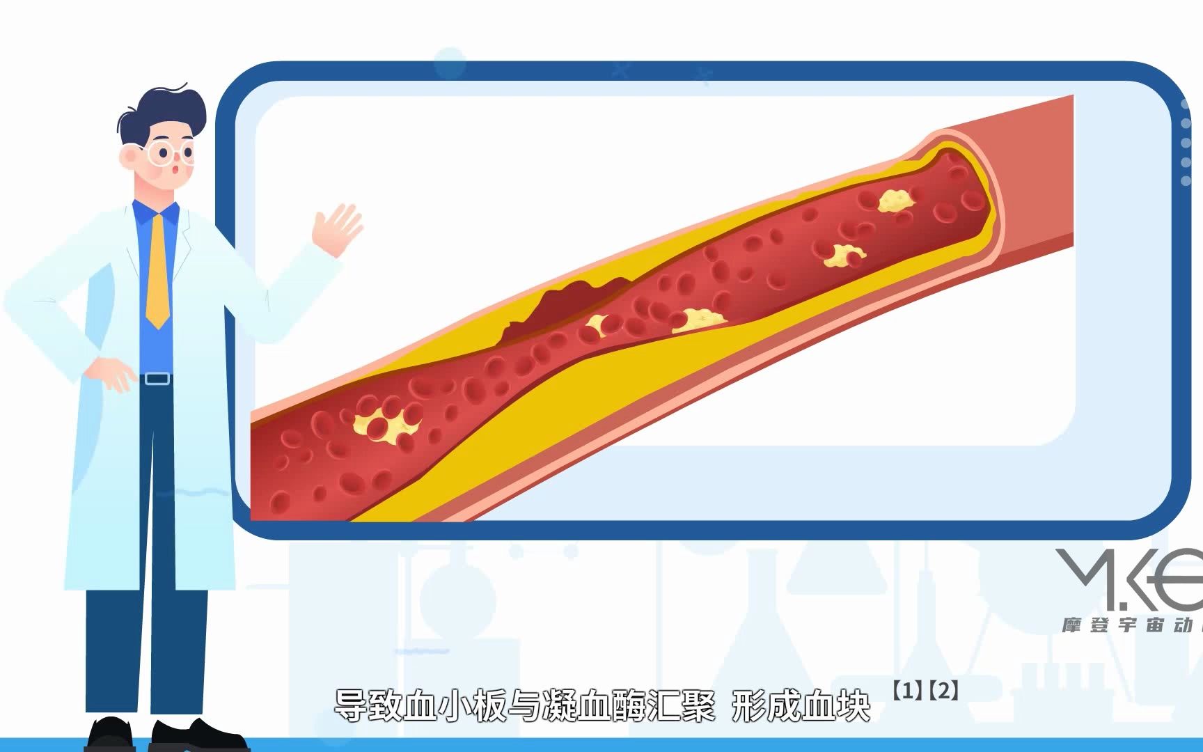 医疗教学动脉硬化动画模拟