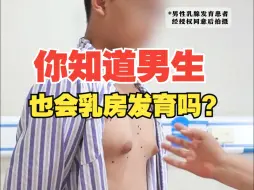 Download Video: 男子胸部发育，穿衣凸起尴尬，摩擦非常疼痛。微创缩胸告别痛苦