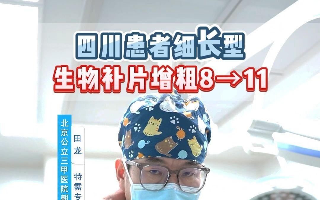四川患者细长型生物补片增粗8→11