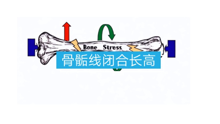 骨骺线闭合长高