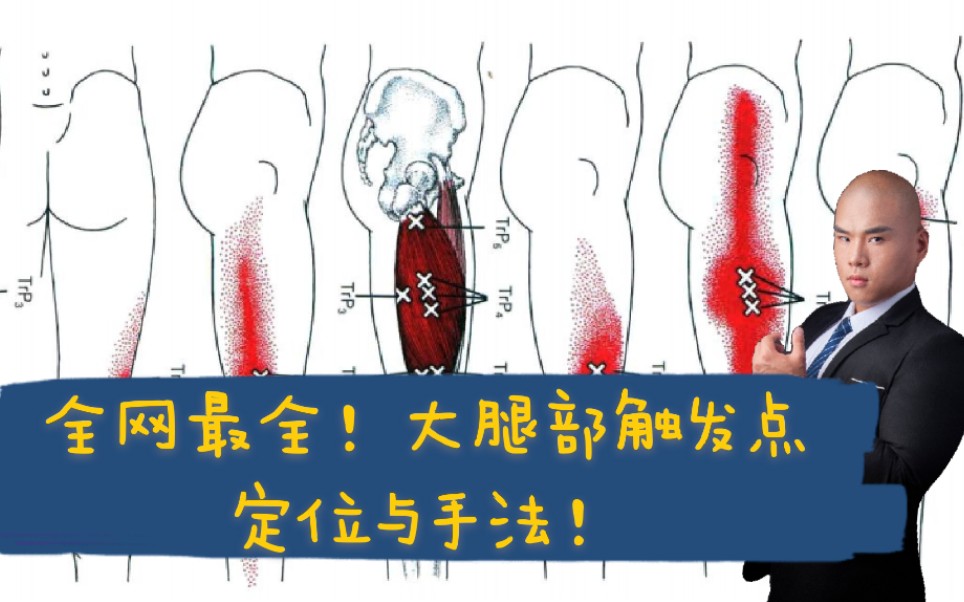 [图]【手法触发点合集】大腿肌肉（股四头肌，内收肌群，腘绳肌，缝匠肌，阔筋膜张肌）板机点，触发点，激痛点定位及手法技巧与细节