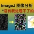 『超实用』ImageJ图像处理 - StarDist助力高难度细胞识别统计