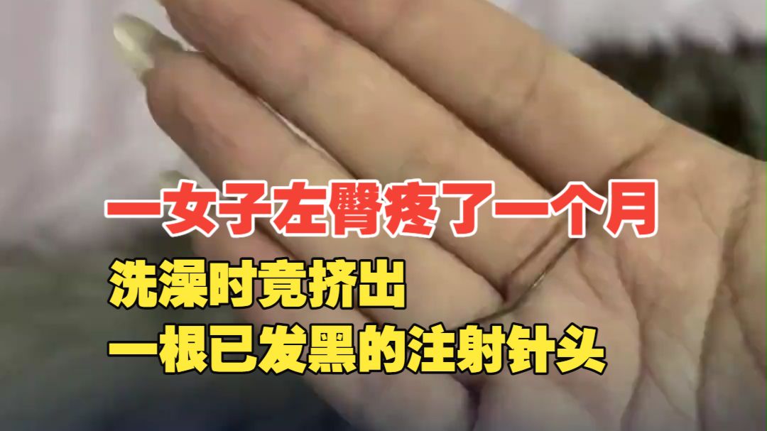 浙江一女子左臀疼了一个月，洗澡时竟挤出一根已发黑的注射针头