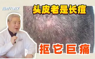 Скачать видео: 【皮肤科教授】头皮长痘习惯去抠？可别抠，听孙叔说要这样做